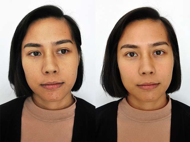We Tried A Beauty Drip For Better Skin And This Is What Happened | Preview.ph We Tried A Beauty Drip For Better Skin And This Is What Happened | Preview.ph