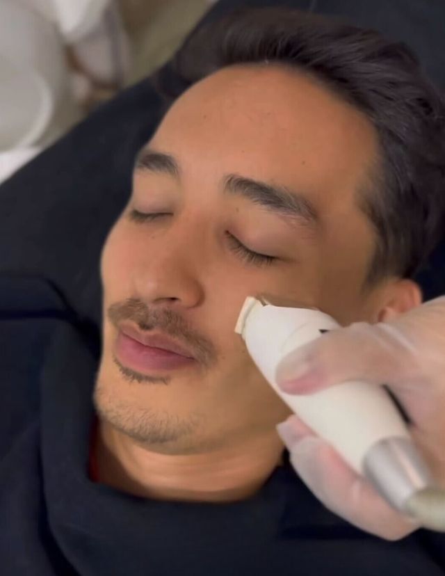 christophe bariou facial reboot