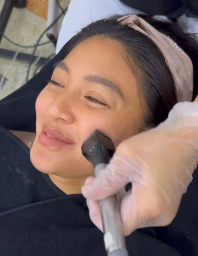 nadine lustre aivee beverly hills lift