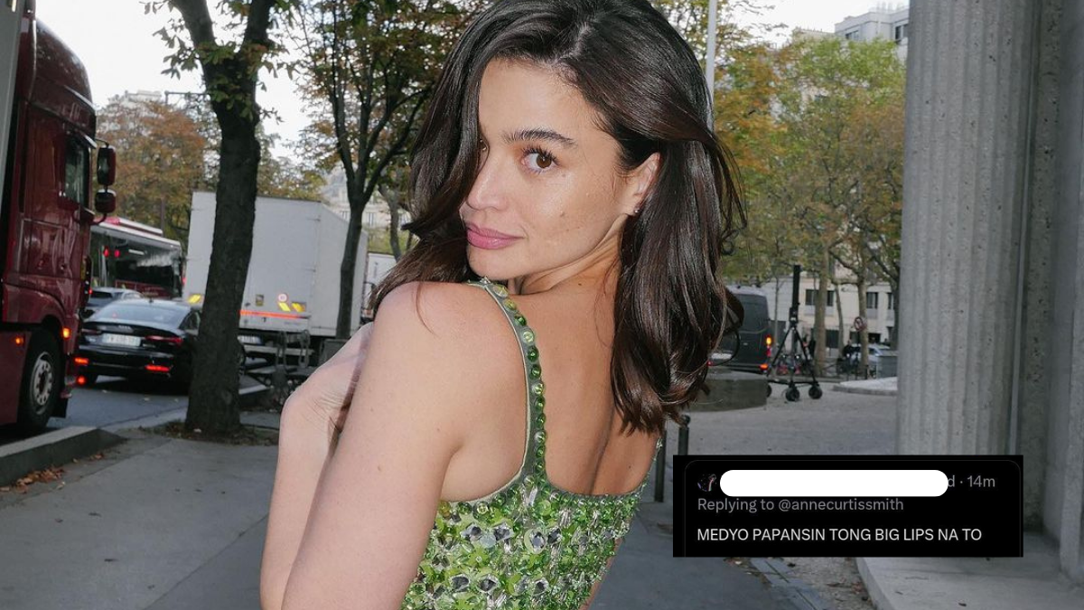 Look: Anne Curtis Responds To Basher Criticizing Her "big Lips" | Preview.ph